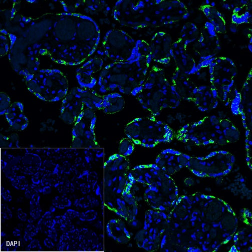 Human Growth Hormone / GH Recombinant Rabbit mAb (SDT-1160-40)