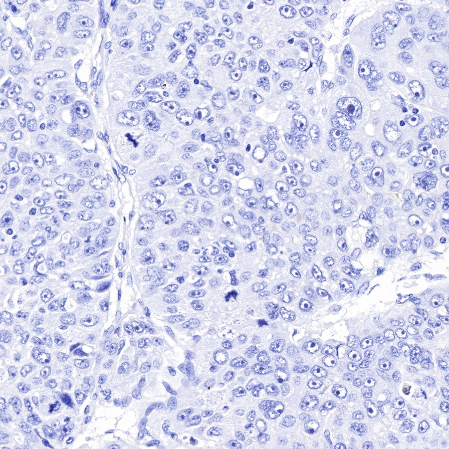 PAPP-A Recombinant Rabbit mAb (SDT-226-46)