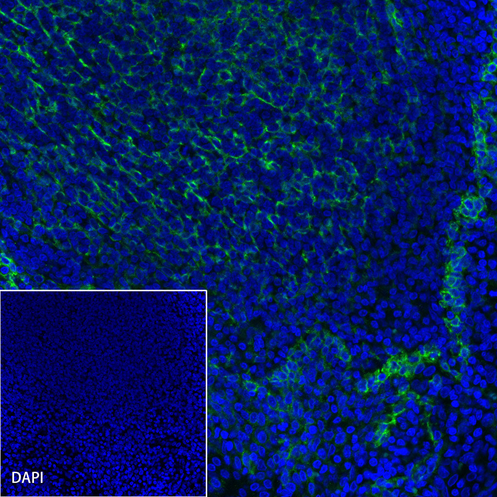 Podoplanin (D2-40) Recombinant Rabbit mAb (SDT-1178-8)