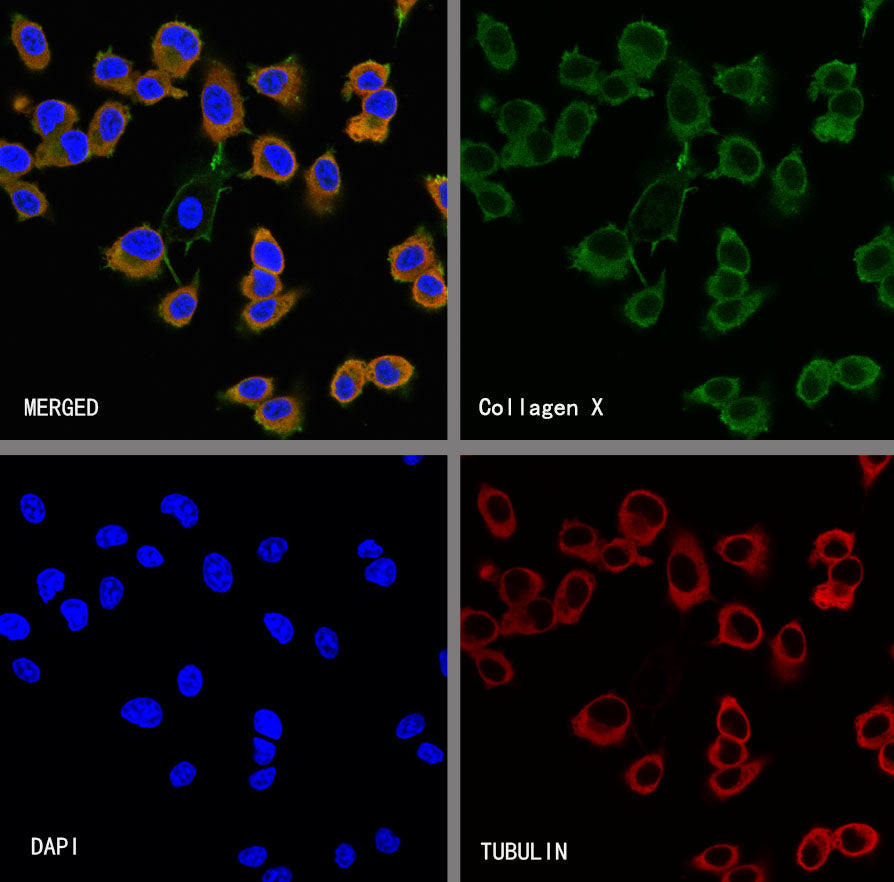 Collagen X Recombinant Mouse mAb (S-M0004)