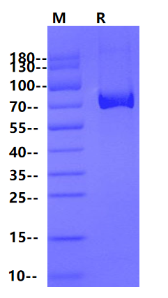 ACHE/Acetylcholinesterase His Tag Protein, Human