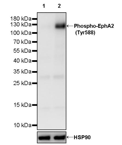 Phospho-EphA2 (Tyr588) Recombinant Rabbit mAb (S-3418)