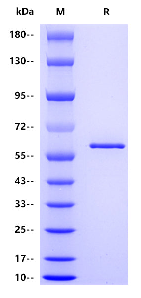 Influenza A virus NP(A/Victoria/2005/2009 H1N1), His tag