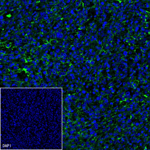 CD19 Recombinant Rabbit mAb (SDT-164-33)