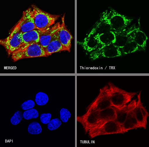 Thioredoxin/TRX Recombinant Rabbit mAb (S-1862-26)
