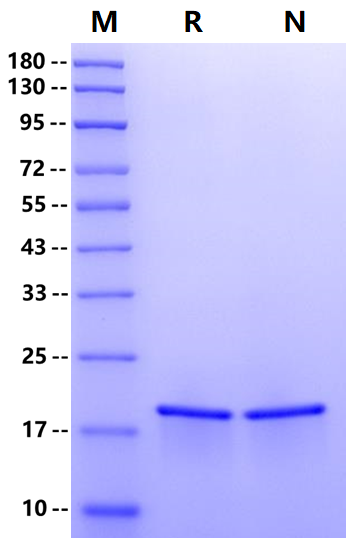 GABARAPL1 His Tag Protein, Human