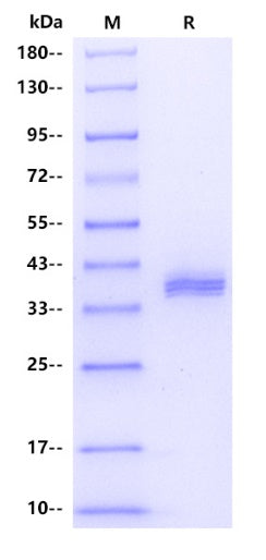 ApoE2 His Tag Protein, Human