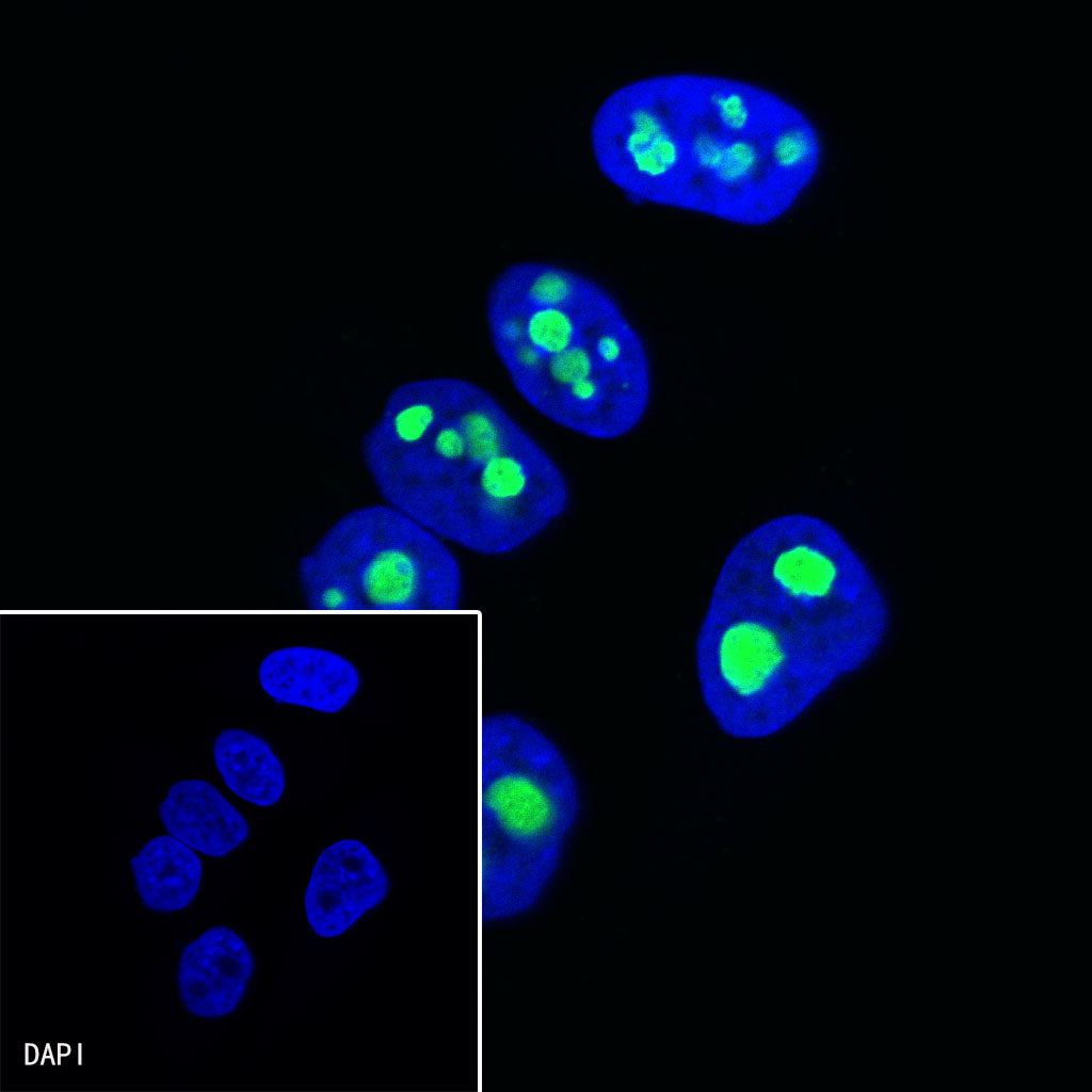 Nucleophosmin/NPM Recombinant Rabbit mAb (S-R231)