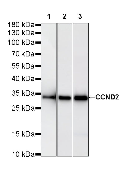 CCND2 Recombinant Rabbit mAb (S-5473)