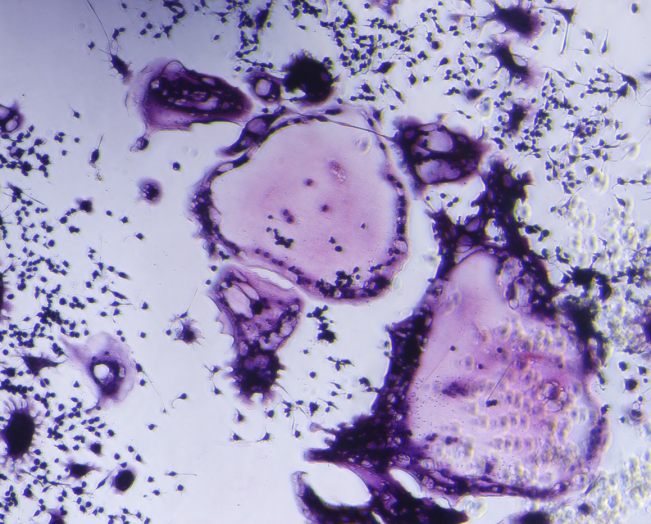 TRANCE/RANK L/TNFSF11 (159aa) Protein, Mouse (RAW264.7 Osteoclast-Specific)