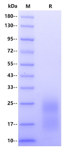 Human PAR1 Protein, His tag