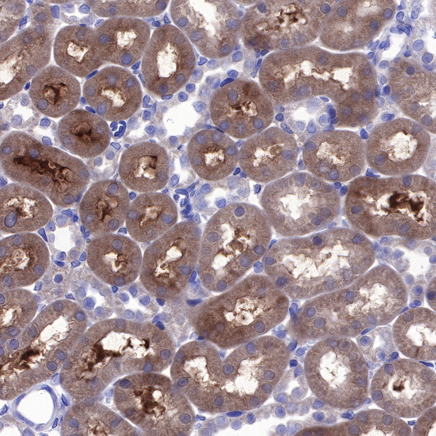 BAX Recombinant Rabbit mAb (SDT-338-76)