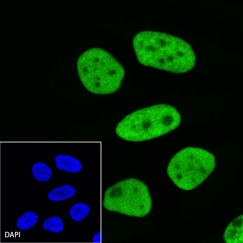 MCM2 Recombinant Rabbit mAb (SDT-018-68-2)