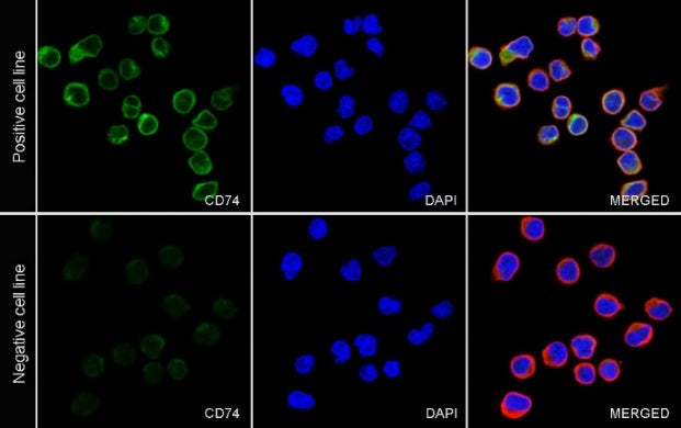 CD74 Recombinant Rabbit mAb (S-560-274)