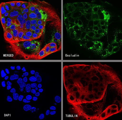 Occludin Recombinant Rabbit mAb (SDT-4588)