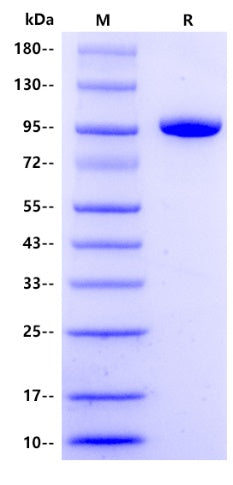 Human ABP1/AOC1 Protein, His Tag