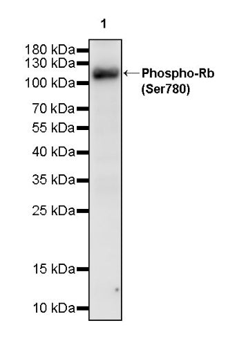 Phospho-Rb (Ser780) Recombinant Mouse mAb (S-3521)