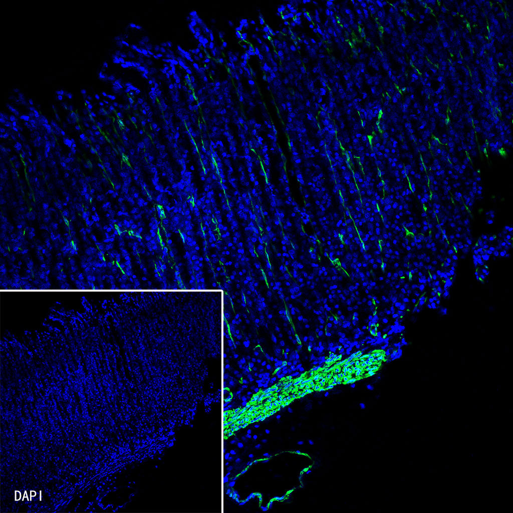 alpha smooth muscle Actin Recombinant Rabbit mAb (Alexa Fluor® 488 Conjugate) (SDT-132-63)