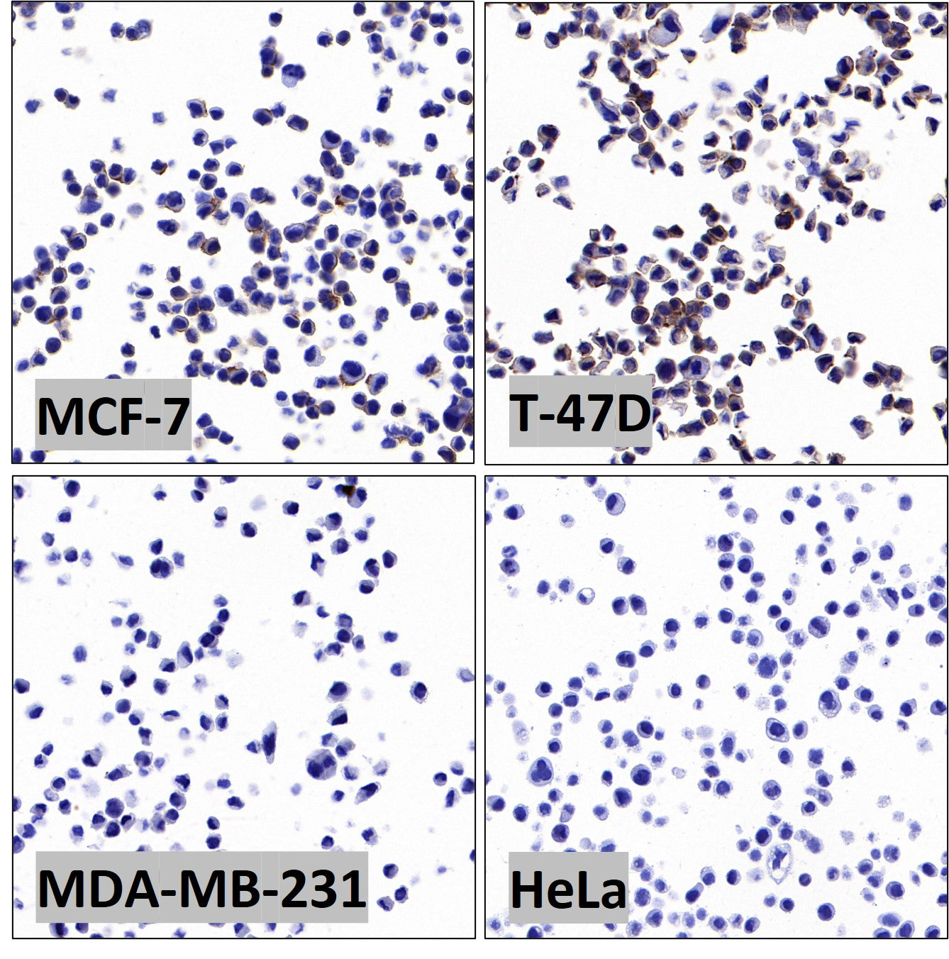 ErbB3 Recombinant Rabbit mAb (SDT-991-14)