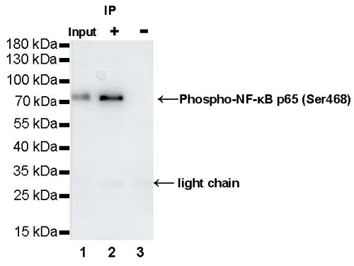 Phospho-NF-κB p65 (Ser468) Recombinant Rabbit mAb (S-1124-133)