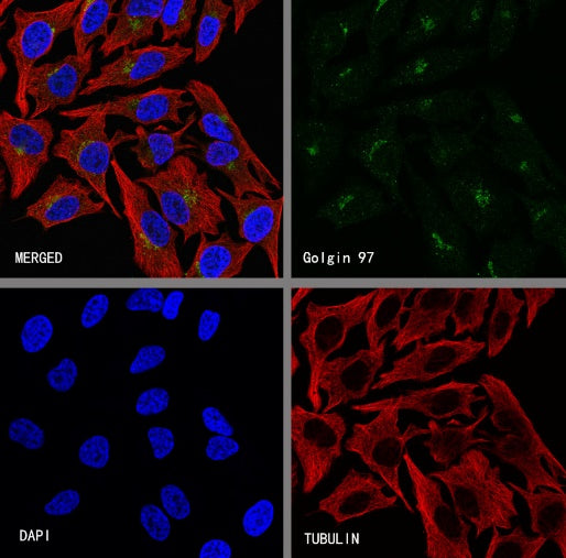 Golgin 97 Recombinant Rabbit mAb (S-6031)