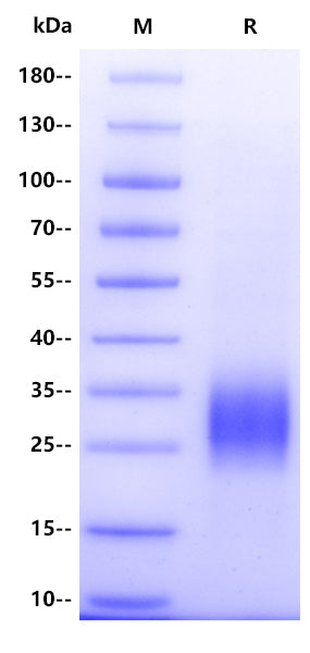 Human SOST/Sclerostin Protein, His Tag