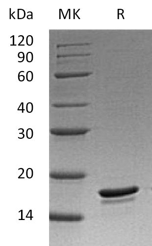 Bc1-w His Tag Protein, Human