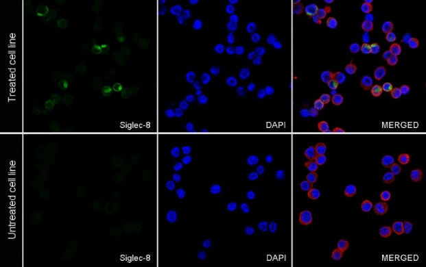 Siglec-8 Recombinant Rabbit mAb (S-2049-19)