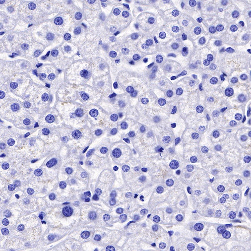 Uroplakin III Recombinant Rabbit mAb (SDT-R177)