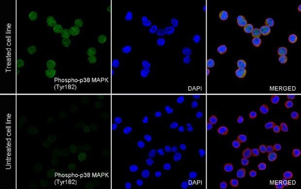 Phospho-p38 MAPK (Tyr182) Recombinant Rabbit mAb (S-617-138)