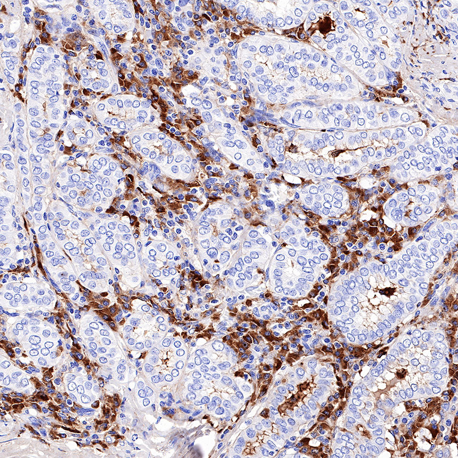 S-RMab® Kappa light chain Recombinant Rabbit mAb (SDT-R130)