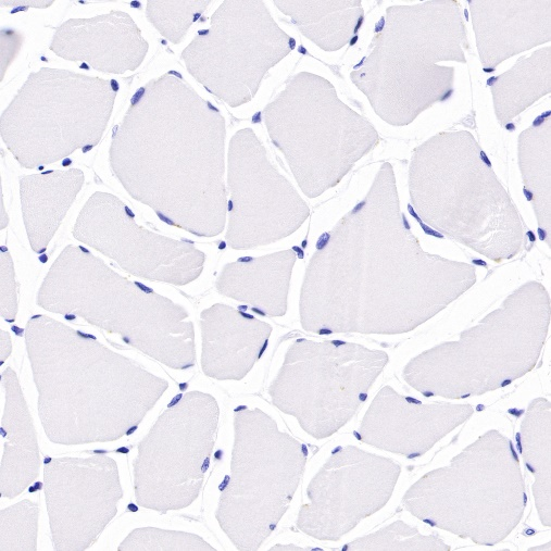 Antibody Diluent