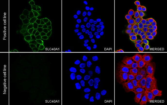 SLC40A1/Ferroportin Recombinant Rabbit mAb (S-2172-35)