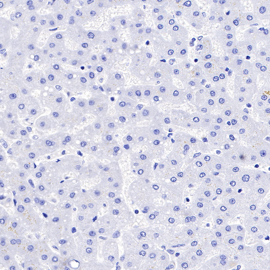 FAP Recombinant Rabbit mAb (SDT-R132)