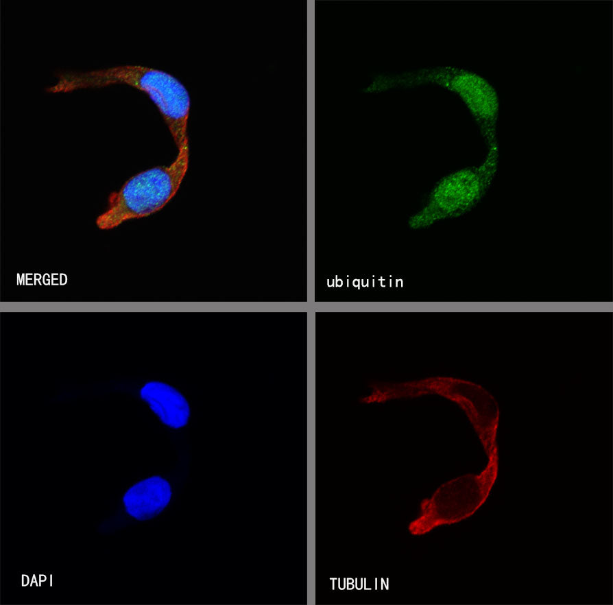Ubiquitin Rabbit mAb (SDT-R095)