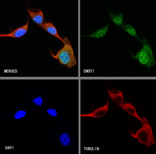 CNOT1 Recombinant Rabbit mAb (S-2273-65)