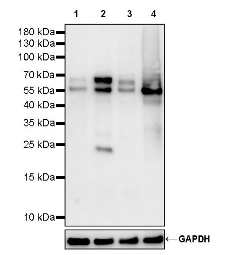 Phospho-c-Myc (Ser62) Recombinant Rabbit mAb (S-3428)