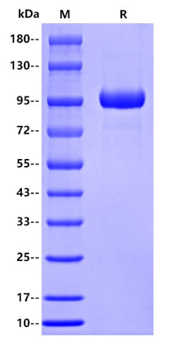 Human MMP-9 Protein, His tag