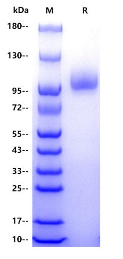 Human VCAM-1/CD106 Protein, His tag