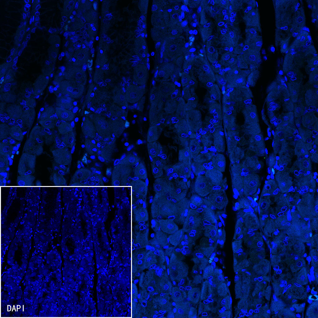 S-RMab® Helicobacter pylori Recombinant Rabbit mAb,PBS Only (SDT-R273)