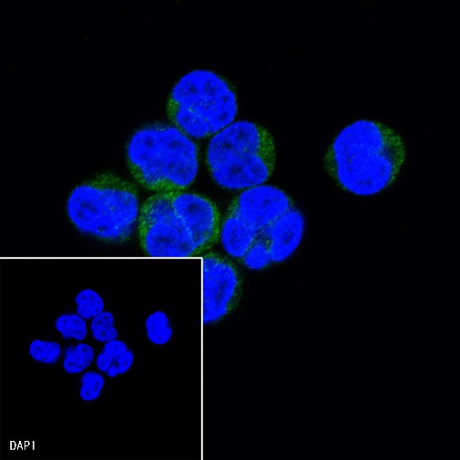 CD25/IL-2Rα Recombinant Rabbit mAb (S-R223)