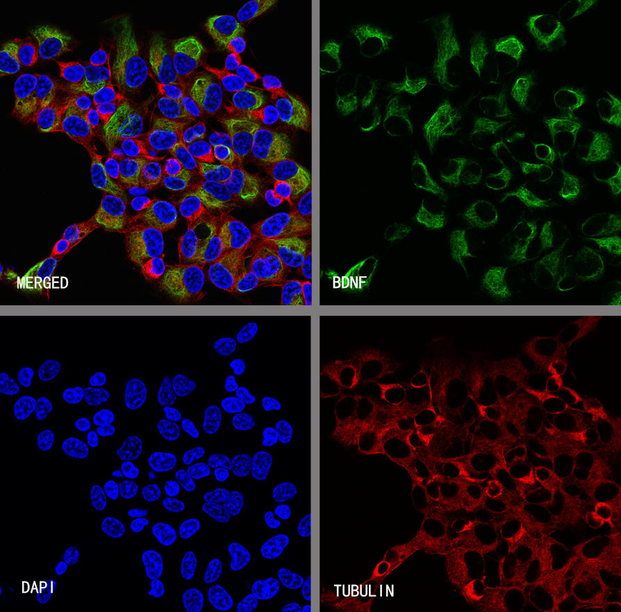 BDNF Recombinant Rabbit mAb (S-4118-38)