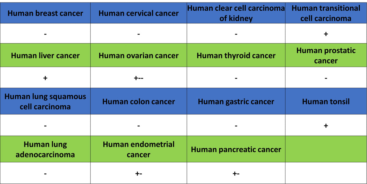 ROBO1 Recombinant Rabbit mAb (S-2931-169)