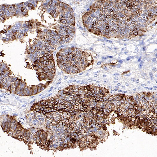 CD57 Mouse mAb (S-R571)