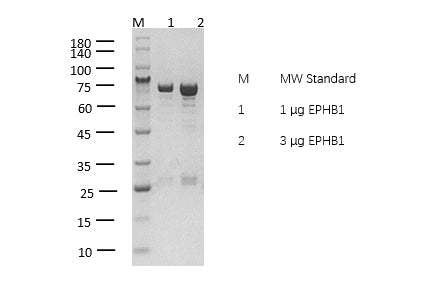 EPHB1 Protein