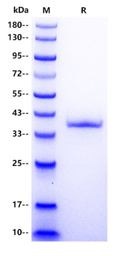 Human CCL20 Protein, hFc tag
