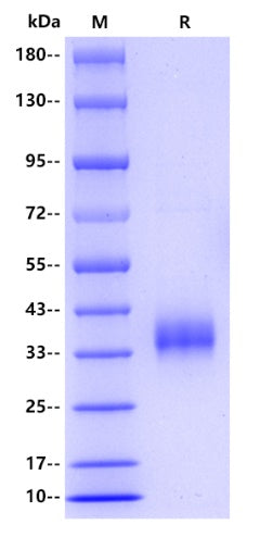 Human Langerin/CD207 Protein, His tag