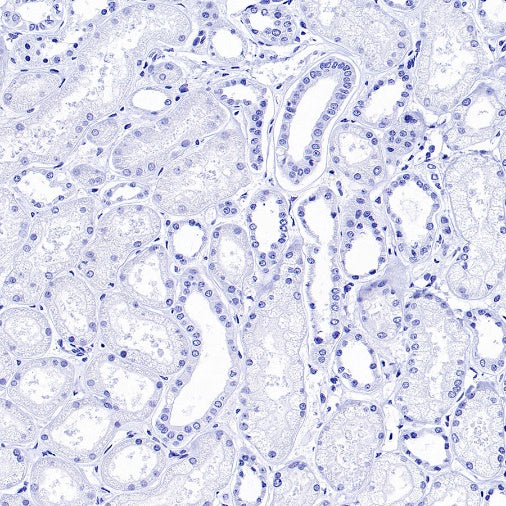 CCL17 Recombinant Rabbit mAb (S-1847-7)