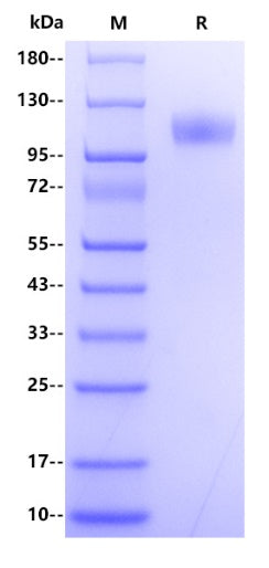 Human RET Protein, His Tag