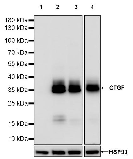 CTGF Recombinant Rabbit mAb (S-3356)
